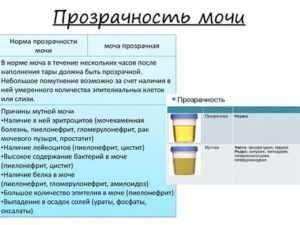 Мутная моча при беременности: причины в первом, во втором и третьем триместрах : saluma.ru