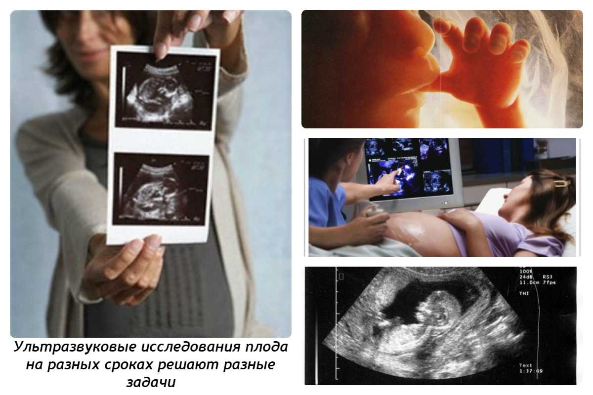 Когда делают узи для определения факта беременности: как готовятся и что показывает в норме, погрешность