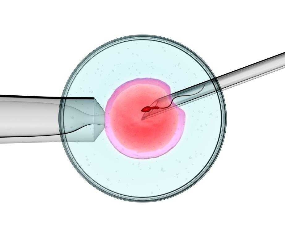 Вспомогательные репродуктивные технологии - assisted reproductive technology - qaz.wiki