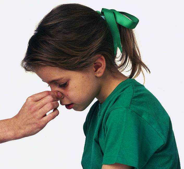 Почему у ребенка кровь из носа и как ее быстро остановить