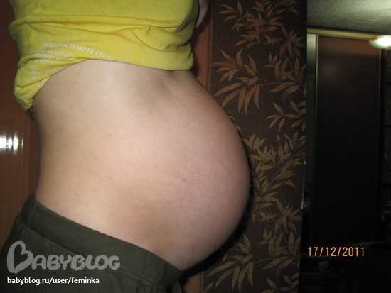 Беременность 32 недели родился