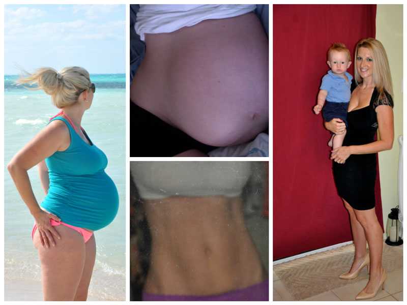 До и после беременности фото. Похудение после родов. Фигура после родов.