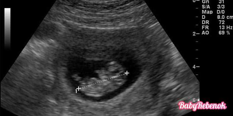 Узи на 4 неделе беременности (26 фото): размеры плода, можно ли делать узи на 3-4 неделе, что видно на 4 неделе от зачатия