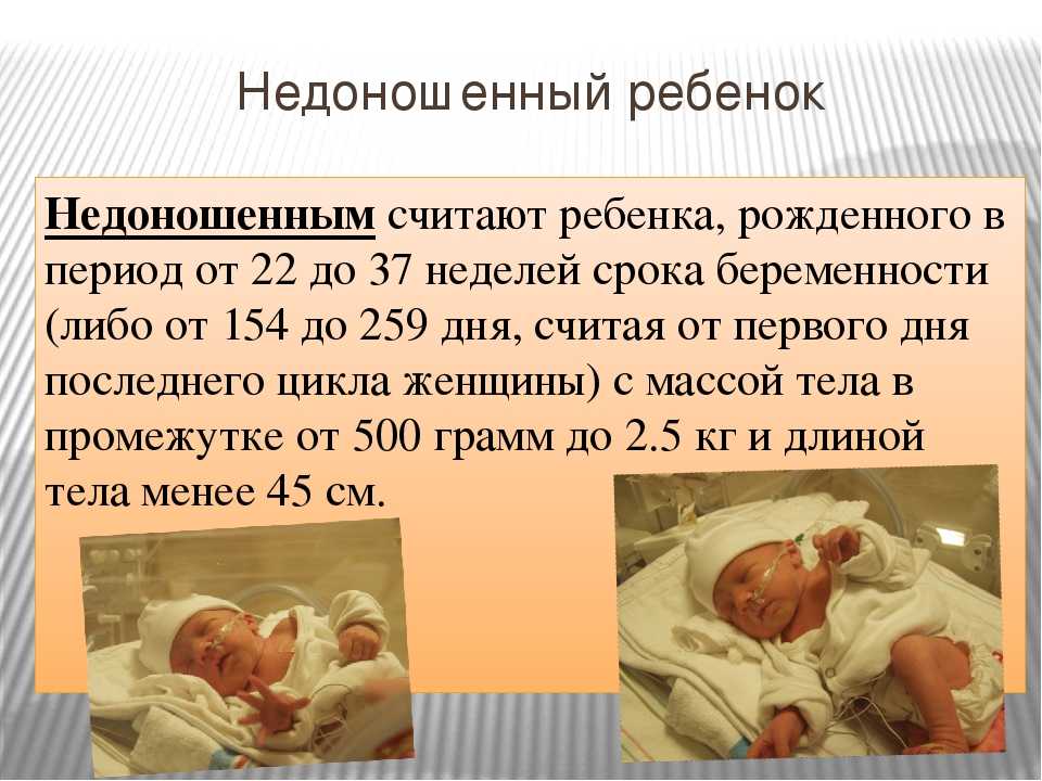 Недоношенные дети: кормление, уход и развитие по месяцам / mama66.ru