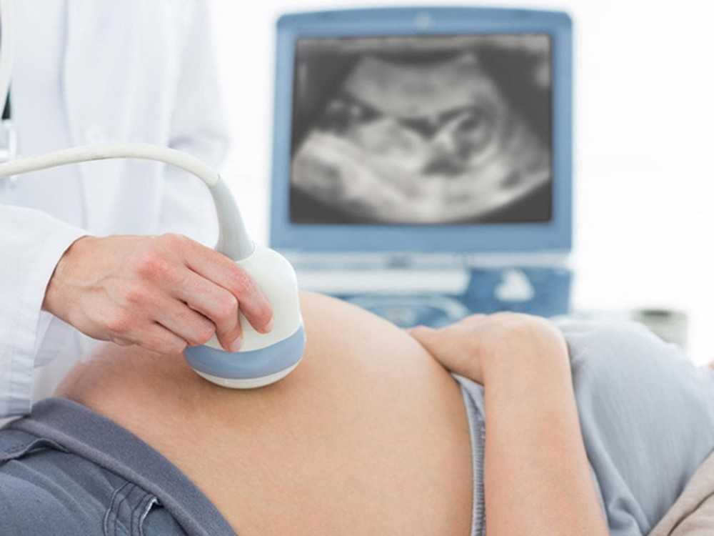Как определяют срок беременности по результатам узи
