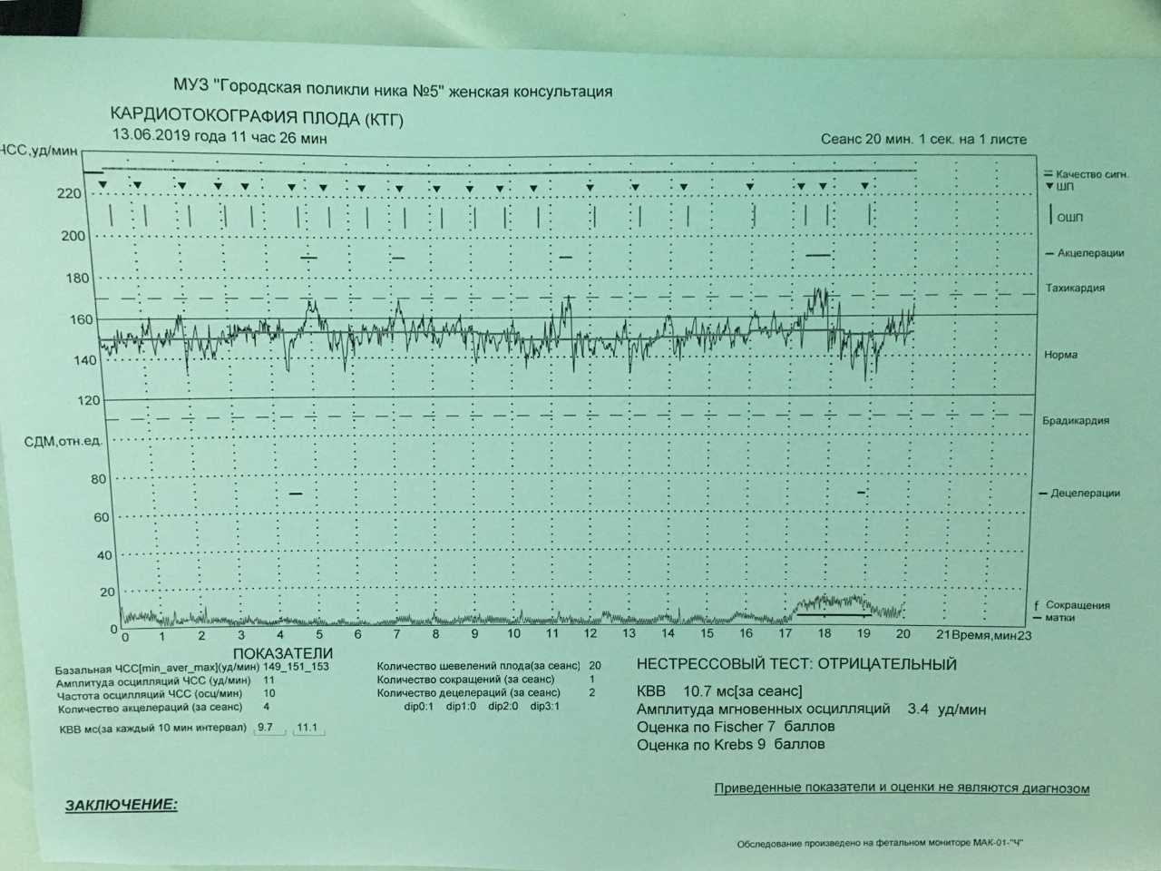 Сердцебиение на 38 неделе. Нормы по КТГ В 35 недель беременности. Нормальная диаграмма КТГ. КТГ-мониторинг алгоритм.