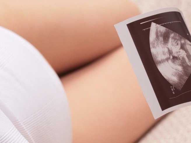 Тонус матки при беременности в 1, 2 и 3 триместре - чем отличаются? по каким симптомам определить тонус матки? чем он может быть опасен и как его снять?