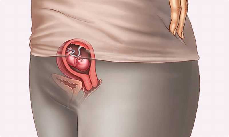 Нормальные и патологические выделения на 14 неделе беременности