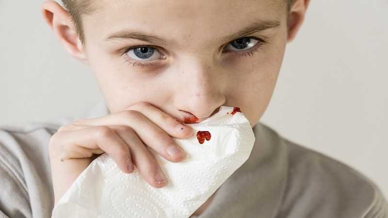 Из носа сильно течет кровь. почему не останавливается кровь из носа и что делать при носовом кровотечении