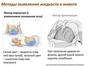 Икота у ребенка: причины частой икоты, как избавить и остановить быстро в домашних условиях, если ребенок икает