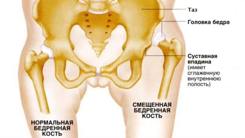 У грудничка хрустят суставы: причины хруста, лечение