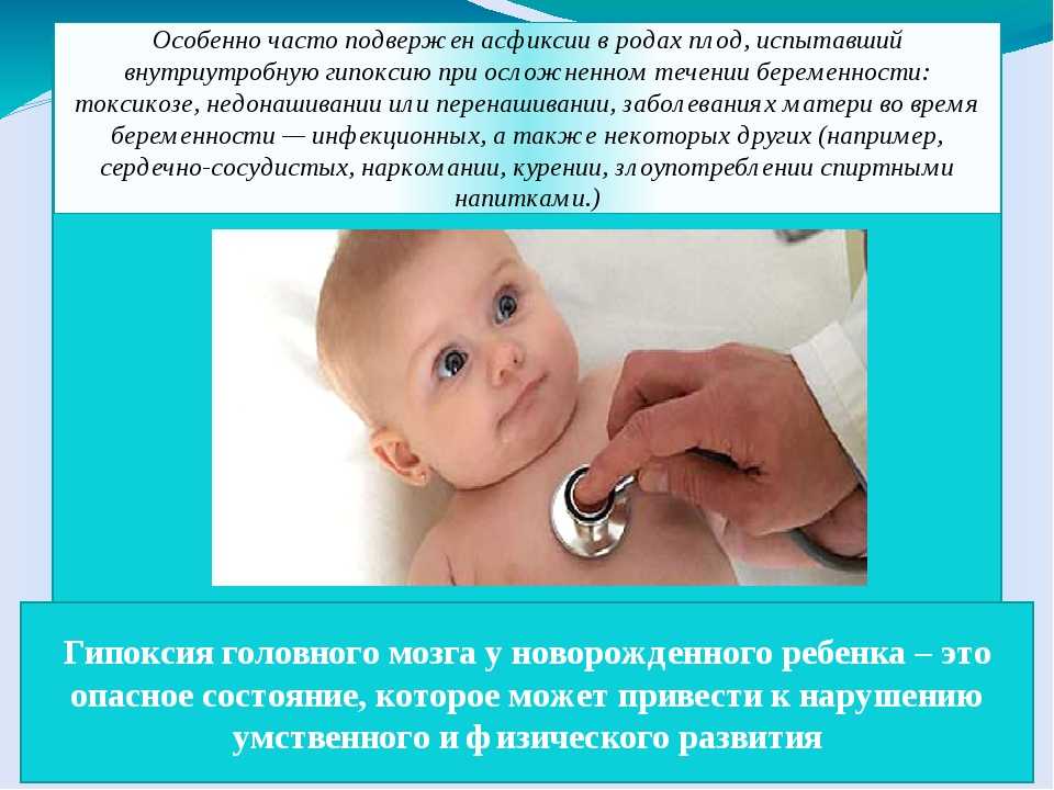 Лечение кровоизлияния в мозг у новорожденного ребенка