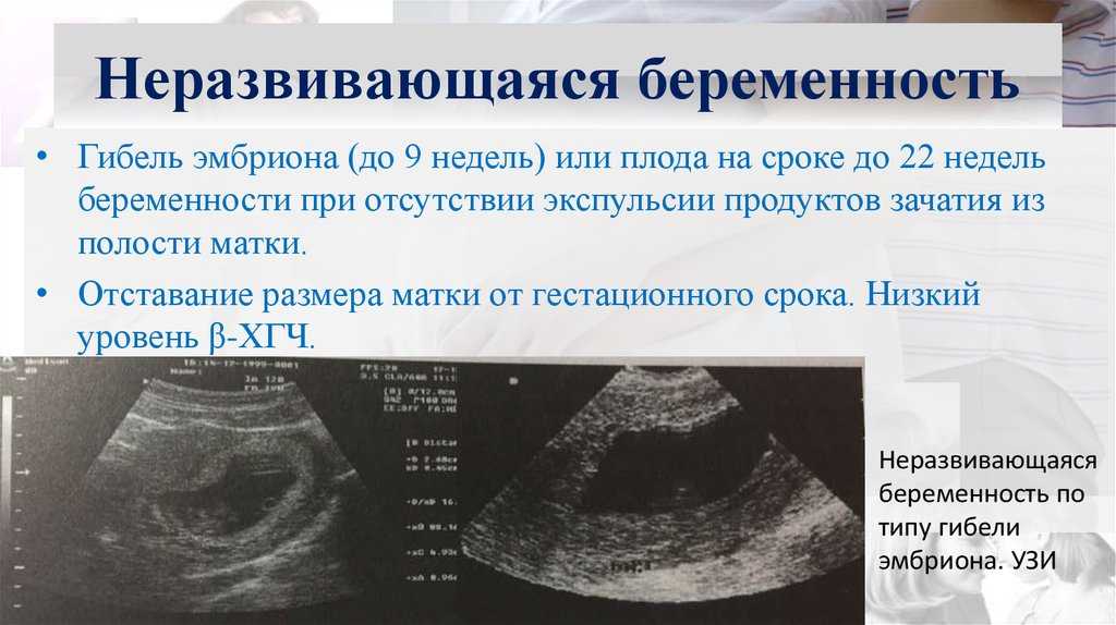 Узи на ранних сроках беременности (22 фото): как часто можно делать, что первое покажет и вредно или нет