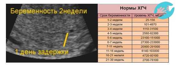 Выделения на 3 неделе беременности (21 фото): тянет низ живота как перед месячными внизу, коричневые или кровянистые выделения на 3 неделе от зачатия
