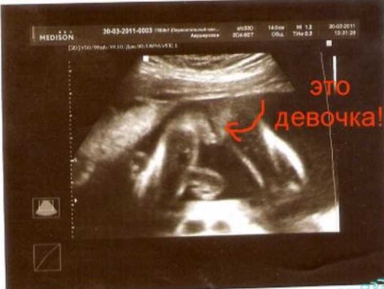 Как выглядит малыш на 6 неделе беременности в утробе матери фото
