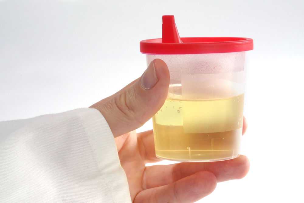 Моча у ребенка прозрачная как вода - советы врачей