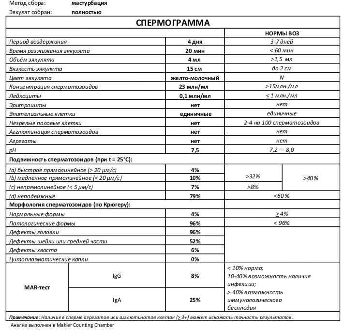 Патология головки сперматозоида, спермограмма, причины и лечение
