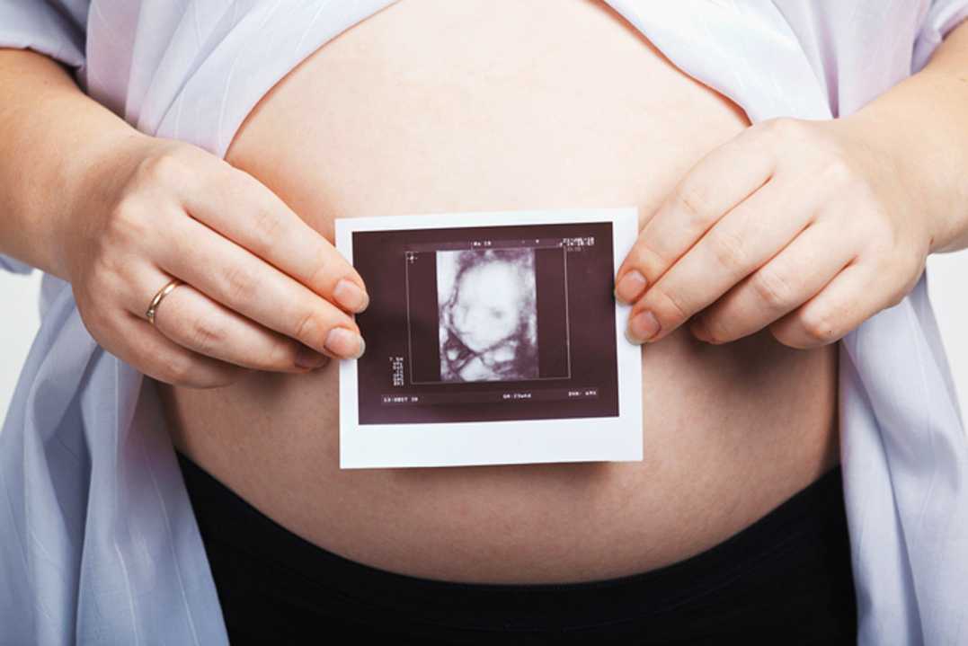 Узи беременности на ранних сроках: можно ли делать, вредно ли для плода? фото