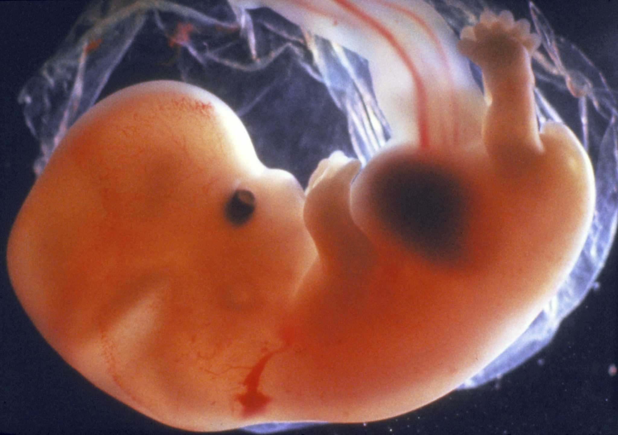 5 неделя беременности: развитие эмбриона, ощущения женщины