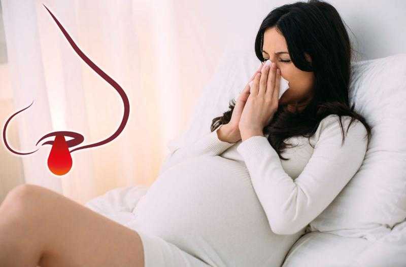 Кровь из носа при беременности: что делать, если идет во время третьего, второго или первого триместра, кровь запекается — заболевания сердца