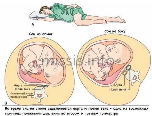 Пульс при беременности: норма по триместрам, как понизить высокий пульс