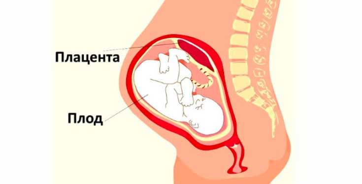 Кровь из носа во время беременности — причины кровотечений в первом, втором, третьем триместре