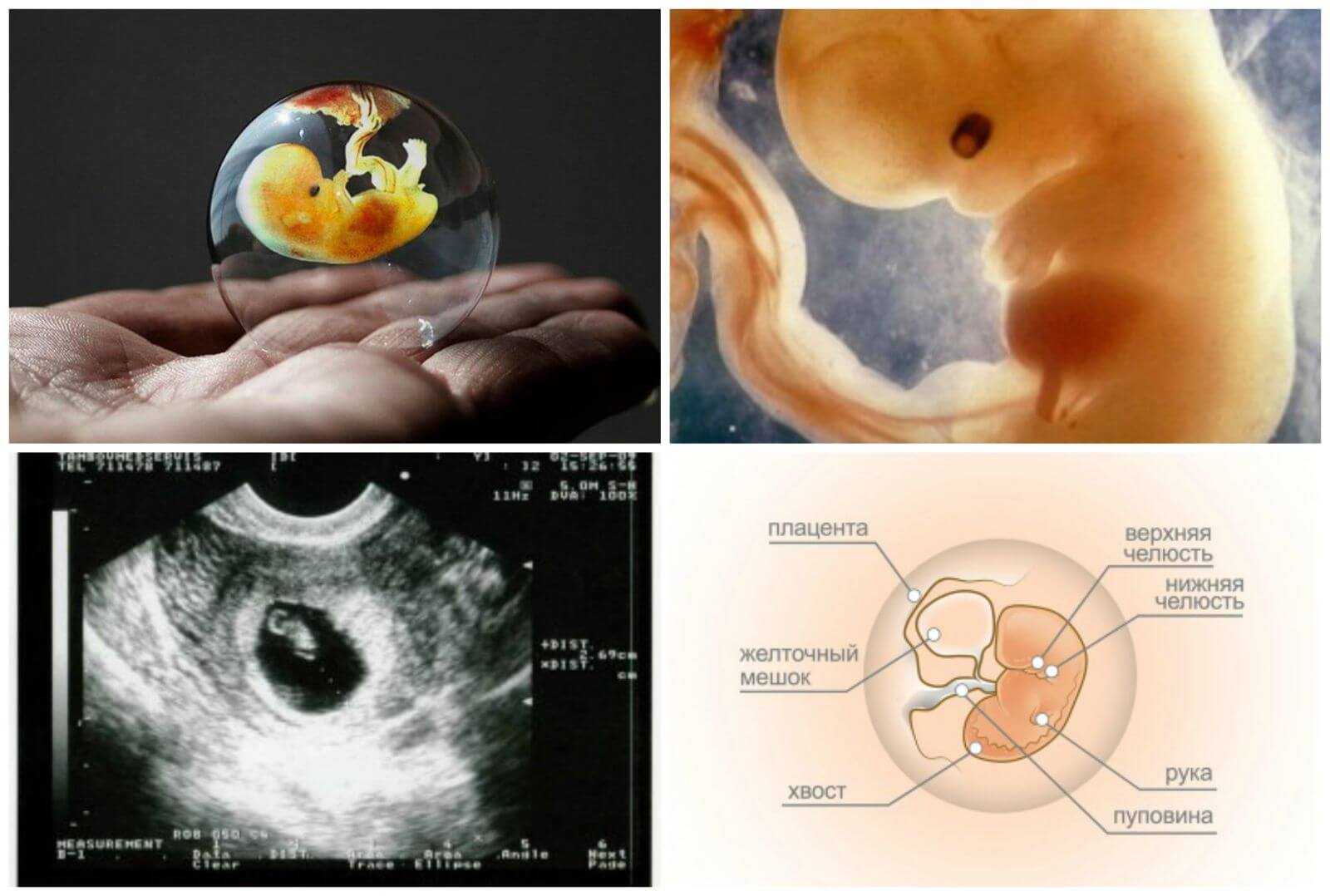 6 недель беременности: что происходит в организме матери и плода?