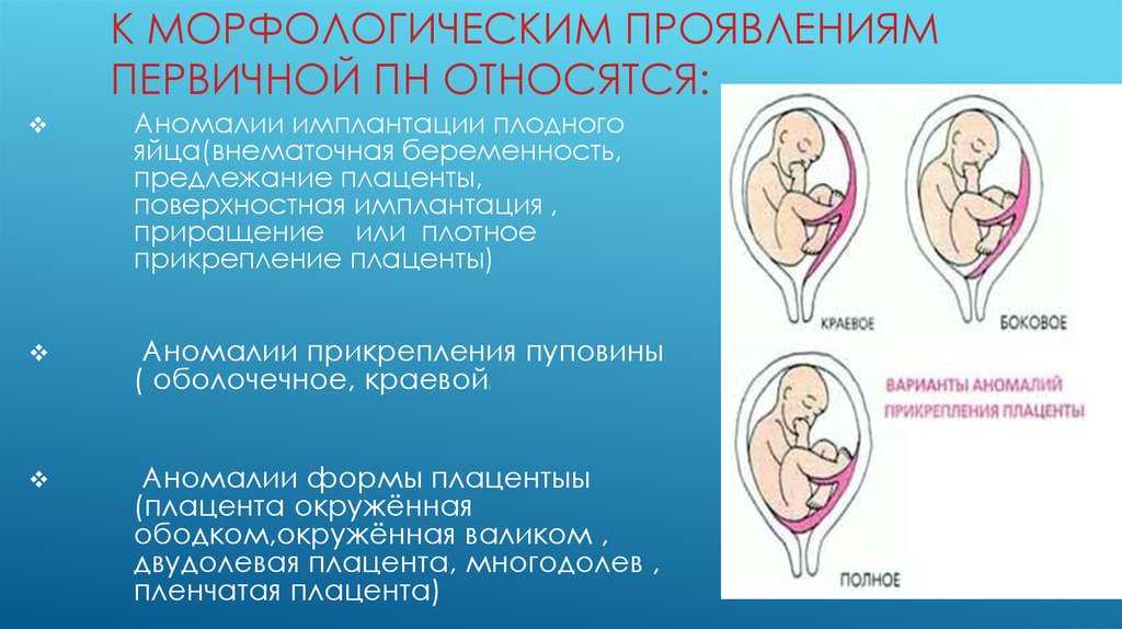 Краевое прикрепление пуповины к плаценте причины - все о беременности