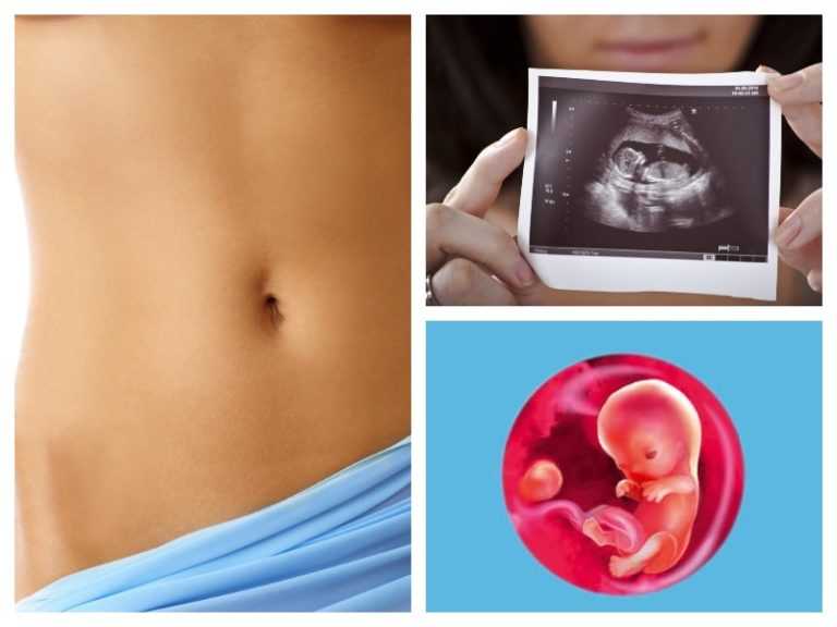 Что происходит на 6 неделе беременности с плодом и женщиной?