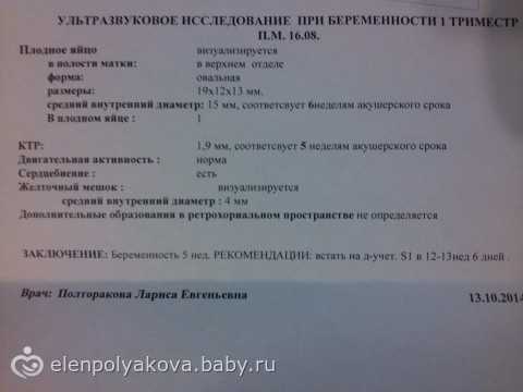 Расшифровка узи при беременности: таблица с результатами, норма и отклонения / mama66.ru