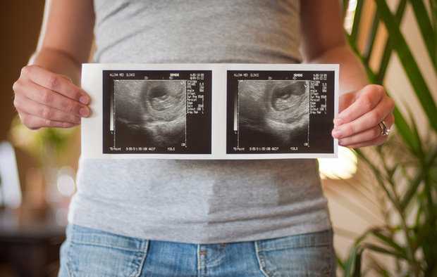 Узи на 9 неделе беременности (28 фото): размер плода, голова ребенка и эмбрионы при двойне