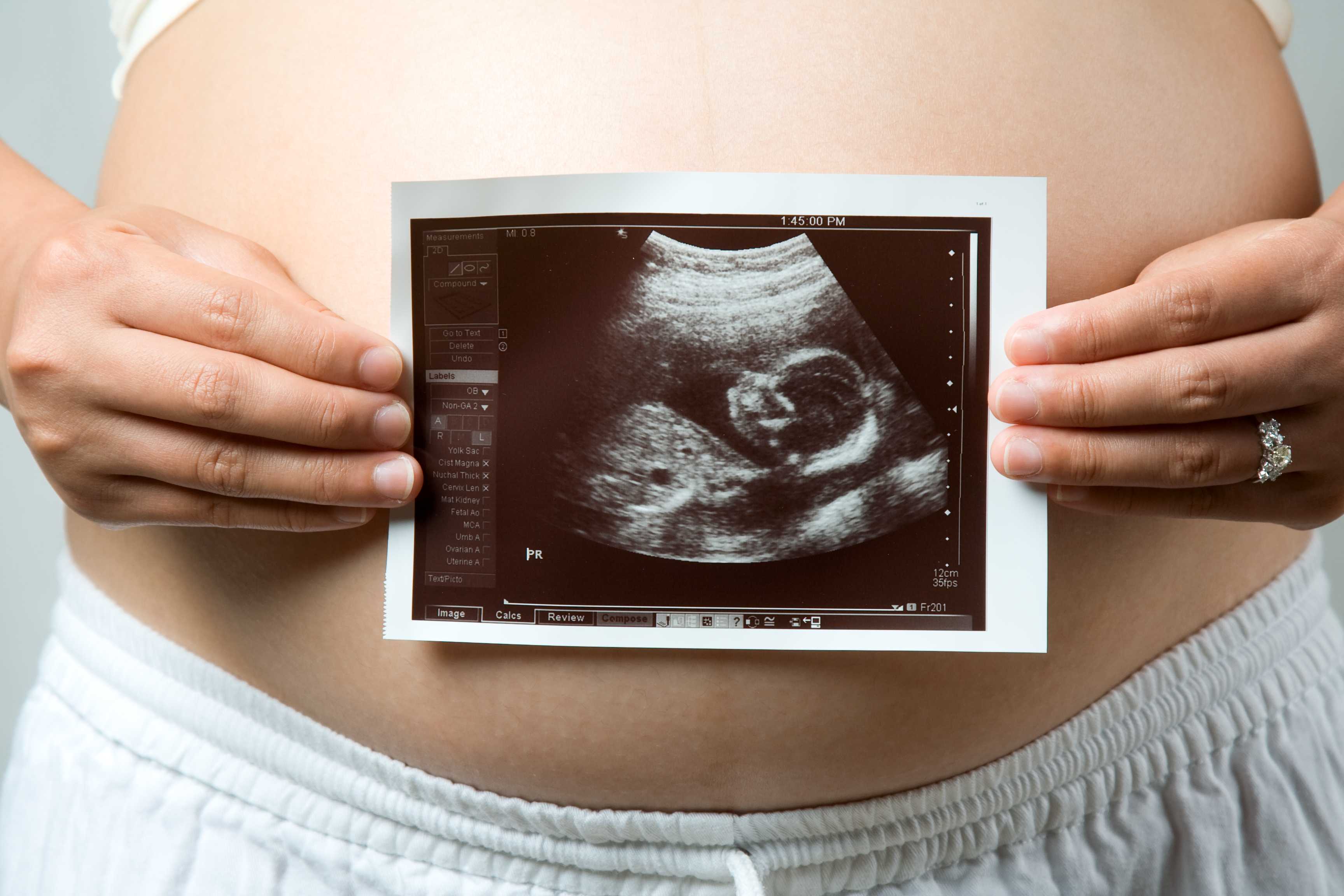 Узи при беременности: на каком сроке и зачем. первое, второе, третье узи по неделям