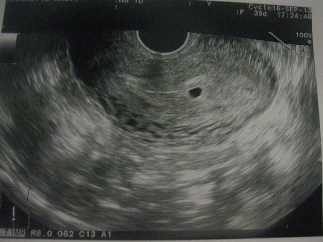 Узи на 4 неделе беременности (29 фото): можно ли делать, размер плода, что видно через 3 недели после зачатия