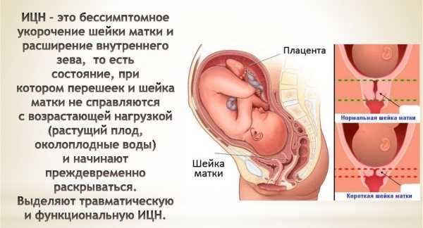 При беременности ощущается матка