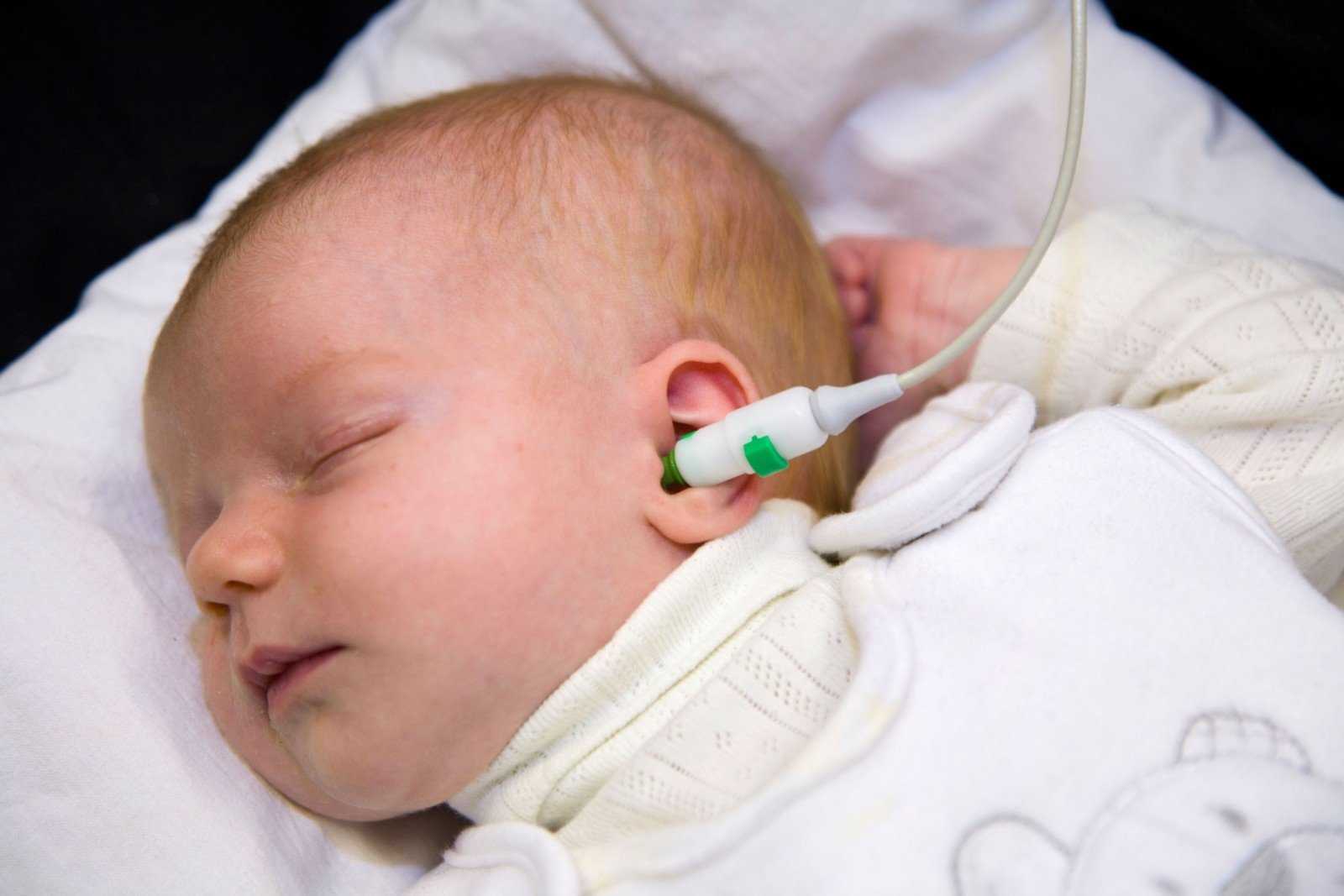 Как проверить слух у новорожденного. Аудиоскрининг новорожденных. Патология слуха у новорожденных. Глухота новорожденных. Аудиологический скрининг новорожденных.
