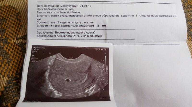 Узи 4 недели беременности от зачатия: можно ли делать, что покажет исследование (фото) и видно ли эмбрион, размеры плода, нормы