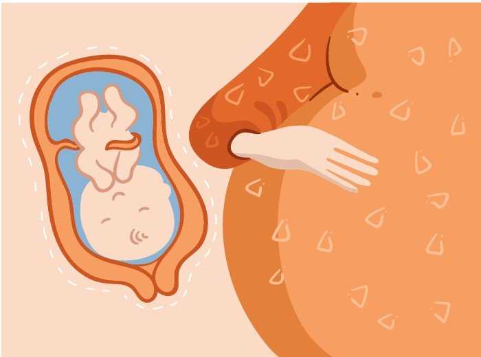 Как вызвать роды на 40 неделе беременности в домашних условиях: методы безопасной провокации схваток, схватки, как ускорить, приблизить, спровоцировать родовую деятельность, быстрее родить,начало родовой деятельности.