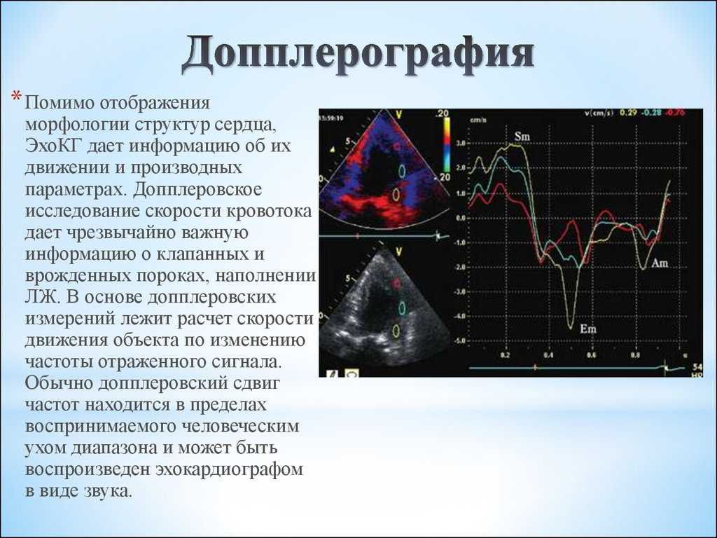 Доплер 2. Допплерография физические основы. Допплерометрия физические основы. Ультразвуковая допплерография принцип метода. Допплеровское исследование при беременности.