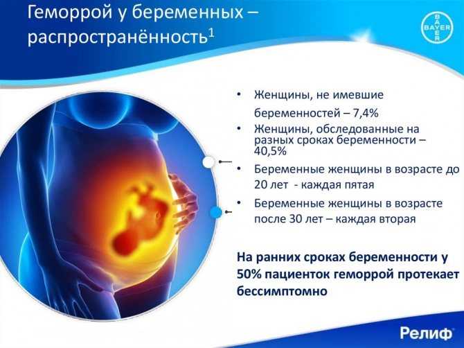 Мази от геморроя при беременности: препараты для беременных в 3 триместре, гепариновая мазь и левомеколь, троксевазин, кремы