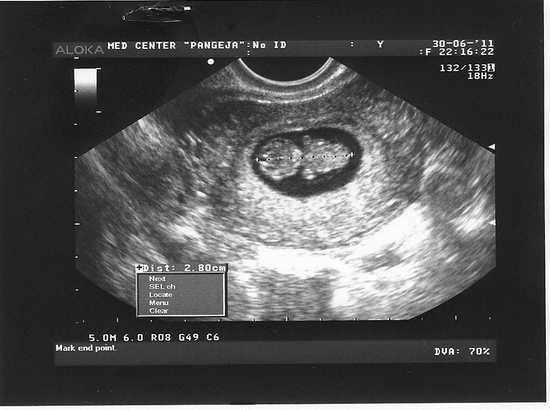 Беременность по месяцам (25 фото): развитие плода по месяцам в утробе матери, ощущения беременной. когда появлется молозиво (молоко) и всегда ли можно летать на самолете? половая жизнь