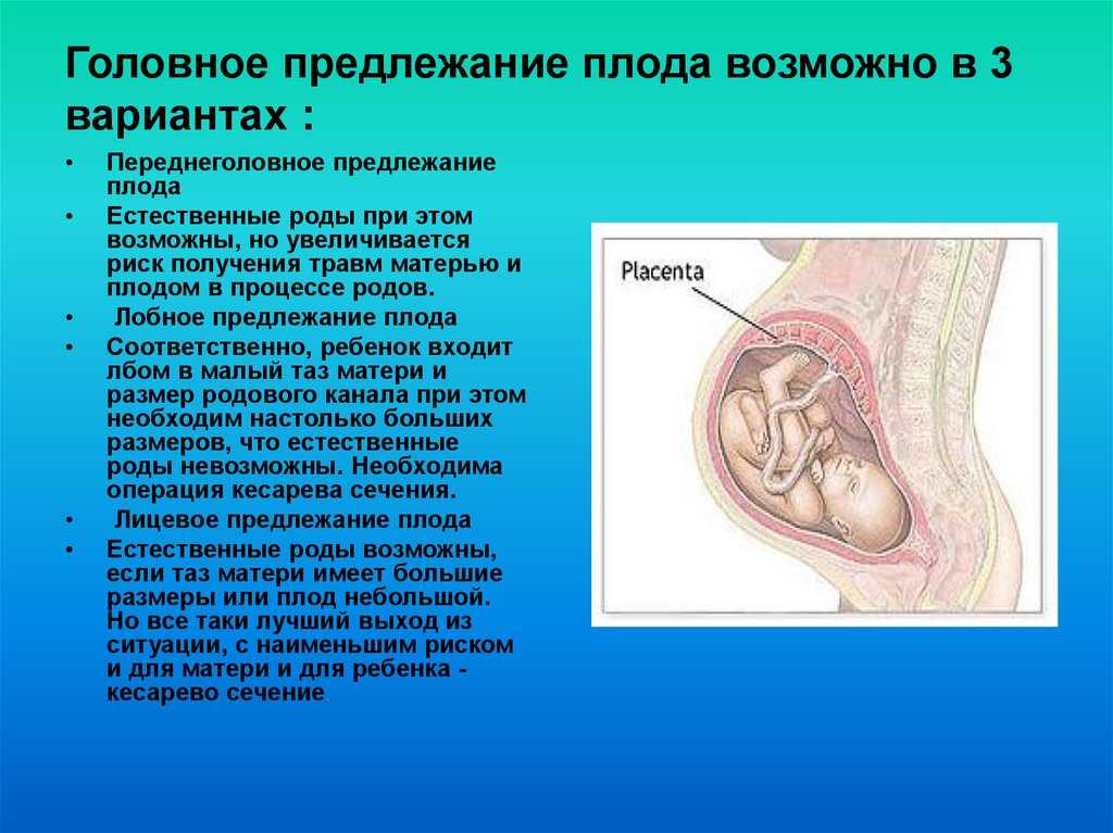 Передне головное предлежание. Головное предлежание плода на 31 неделе беременности. Головное предлежание плода на 32 неделе. Расположение ребенка продольное головное. Положение продольное предлежание головное.