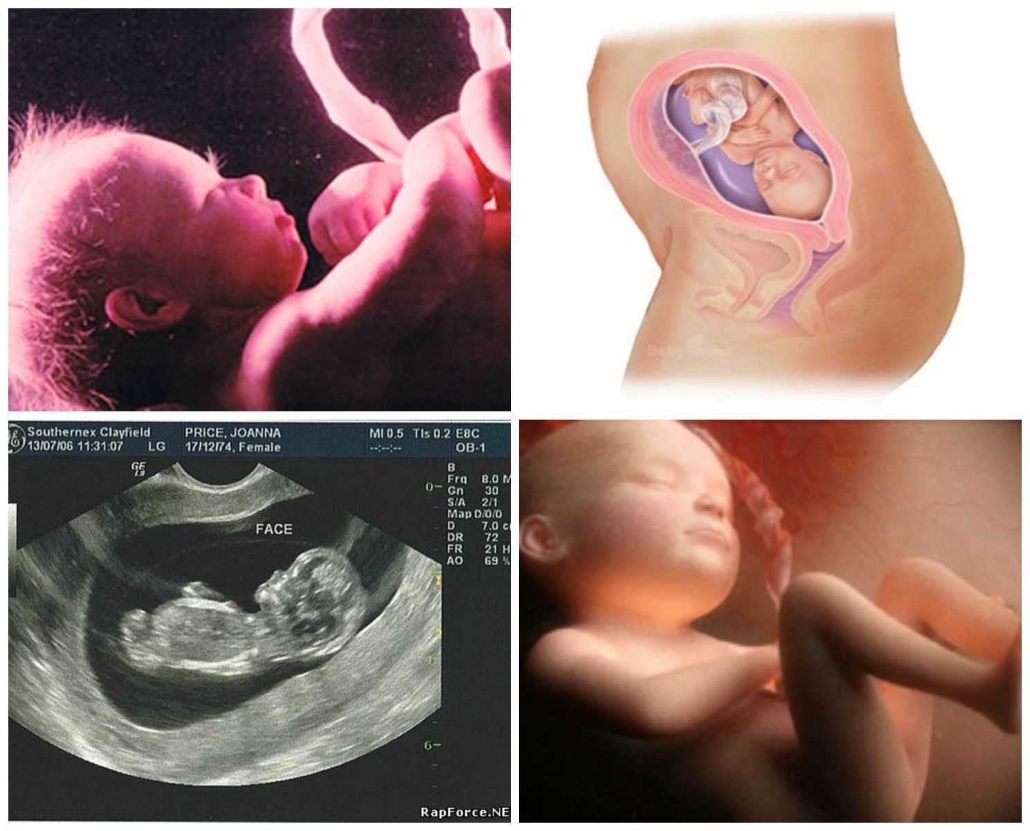 Узи на 9 неделе беременности (28 фото): размер плода, голова ребенка и эмбрионы при двойне