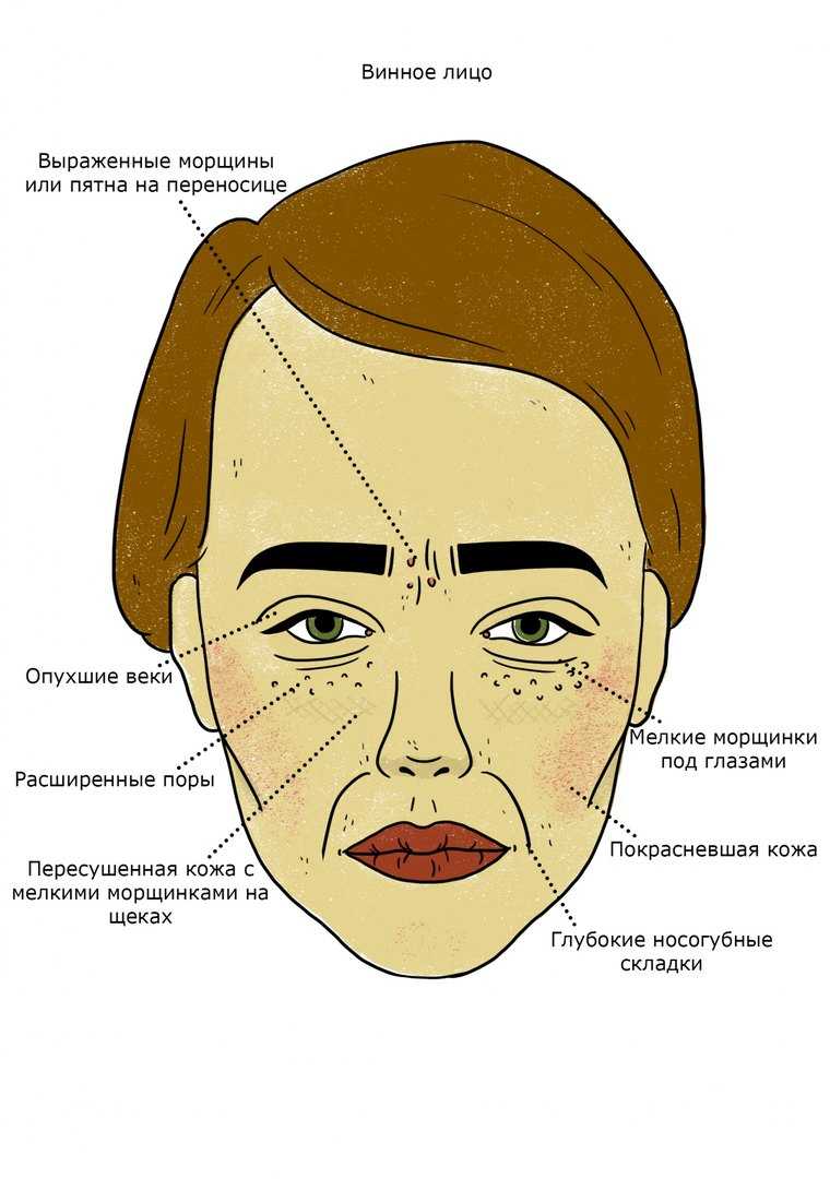 Прыщи на лице у мужчин: причины появления угревой сыпи, лечение, фото