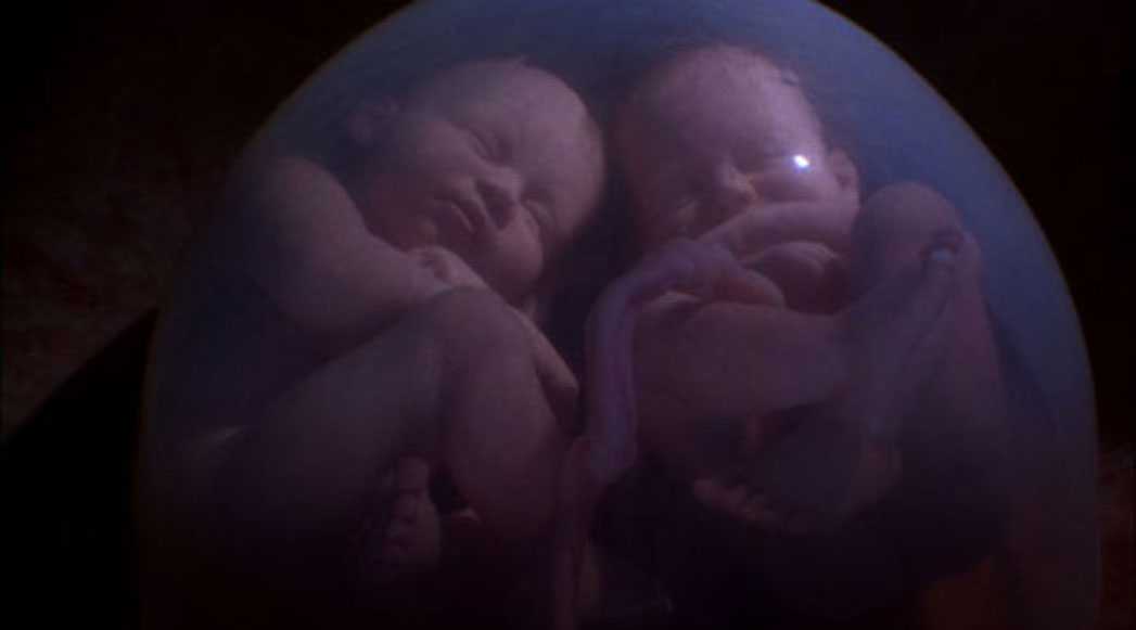Беременность двойней по неделям, особенности беременности близнецами, развитие плода с фото |
            эко-блог