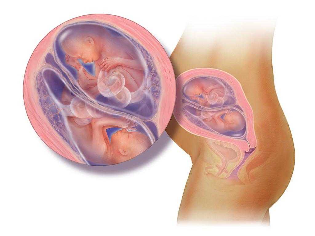 Узи на 5 неделе беременности (23 фото): размер плода, что видно и что покажет, можно ли делать узи, особенности при двойне
